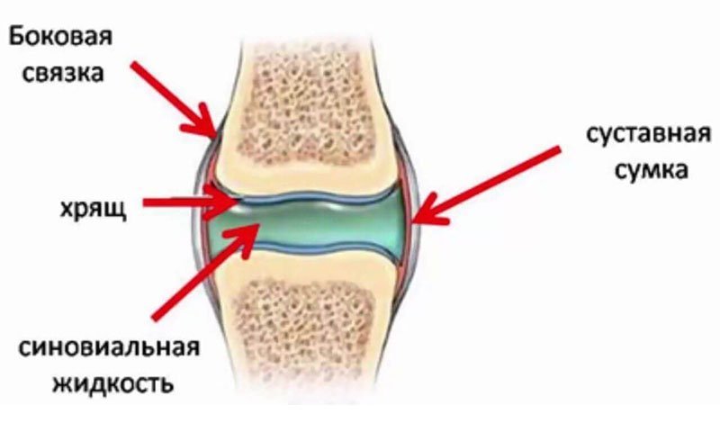 Что такое имплант синовиальной жидковсти